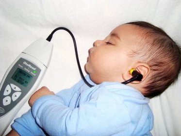 Rastreio auditivo neonatal
