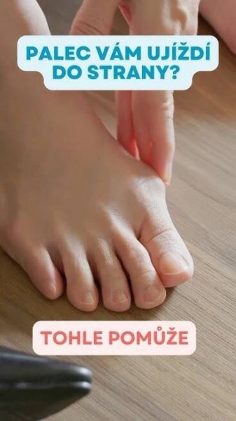 a person has their foot on the table with an ad above it that reads, palec vam ujdzi do strain? to toe ponize