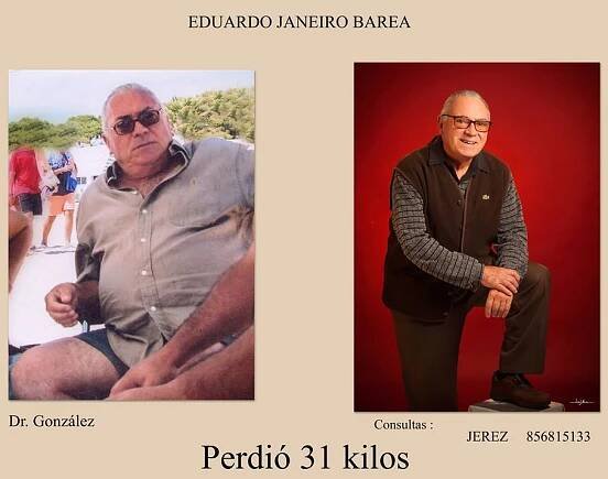 Fotos de pacientes - Doctor Gonzalez - Adelgazamiento y nutricion