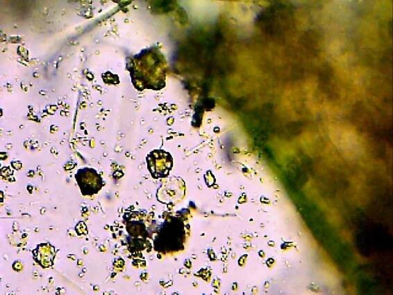 Desulfovibrio