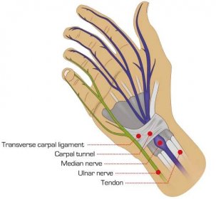 Ulnární nerv prochází do malíčku a prsteníčku a ovlivňuje karpální tunel.