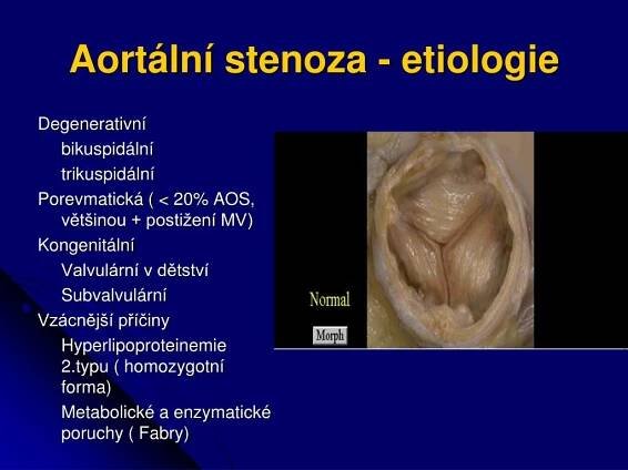 PPT - Aorta PowerPoint Presentation, free download - ID:4563750
