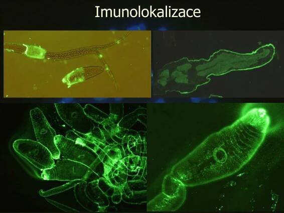 PPT - Speciální světelná a elektronová mikroskopie PowerPoint Presentation - ID:7051427