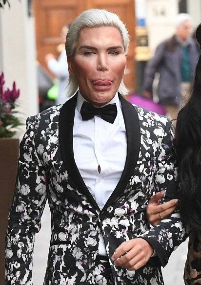 »Lidský Ken« Rodrigo Alves pláče: Rozpadá se mu nos!