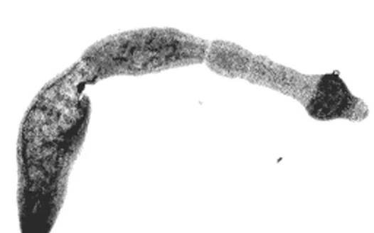 Takto vypadá tasemnice liščí. Ve skutečnosti je velká zhruba 5 mm.