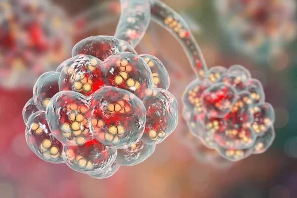 Pneumokoková pneumonie, lékařská koncepce. 3D ilustrace zobrazující bakterie Streptococcus pneumoniae uvnitř alveoli — Stock obrázek