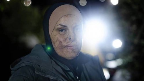Badly burned but free, Israa Jaabis on her release from Israeli prison