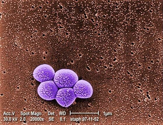 seskupování, meticilin rezistentní staphylococcus aureus, mrsa, bakterie