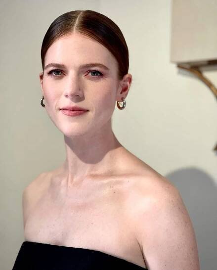 Rose Leslie - Forehead, Skin, Lip, Chin, Shoulder, Eyebro... - Female Celebrities