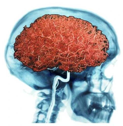 Brain Vessels