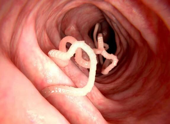 40 Facts About Parasitic Worm