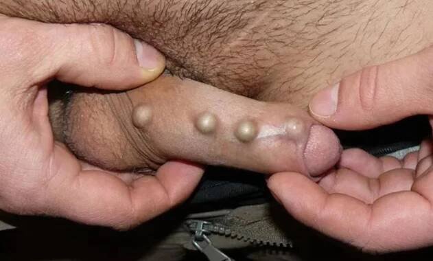 Penis s perličkami