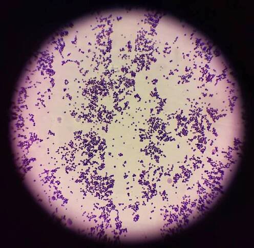 gramovo barvení staphylococcus aureus - zlatý stafylokok - stock snímky, obrázky a fotky