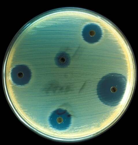 toxinu, staphylococcus aureus, nemoci, stafylokokové, intoxikace