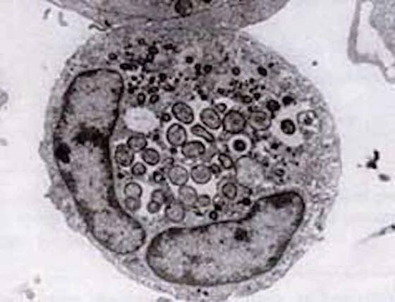 Anaplazmóza | Rencana