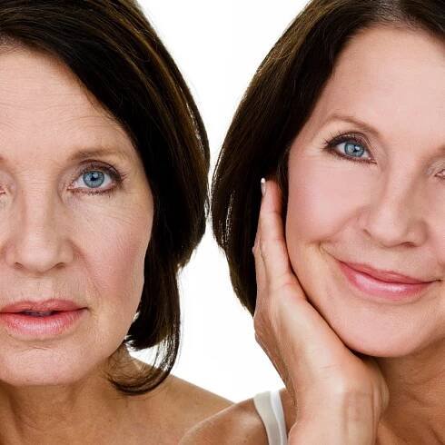 Dermalift Face Lift & Firm