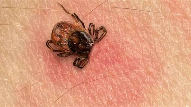 Jak správně odstranit klíště v pěti krocích