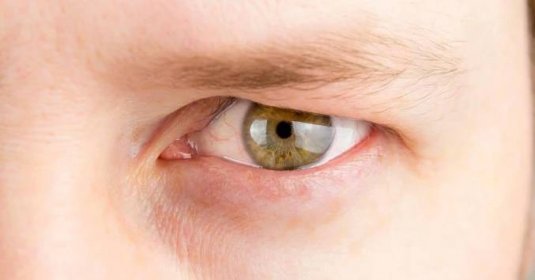Operace očních víček: Co byste měli vědět před zákrokem [year]