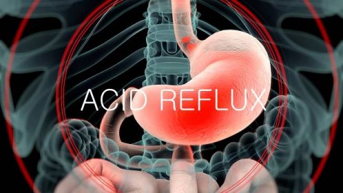 Trápí vás reflux? Principy Metabolic Balance poskytnou řešení