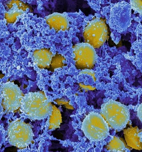 Baktéria Staphylococcus aureus