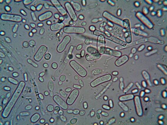 What Is Oxidative Stress?