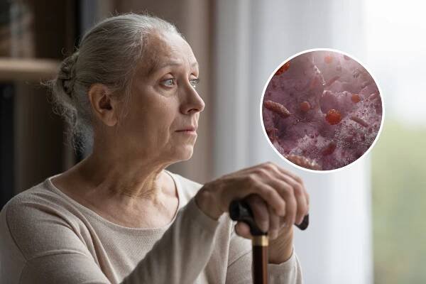 Alzheimer's link with gut health revealed by new study of causes