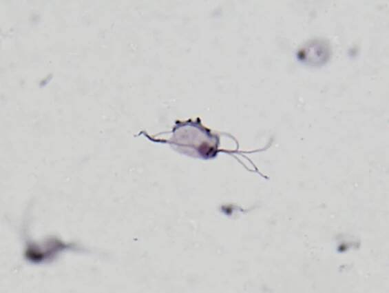 Trichomonády – Príma receptář.cz