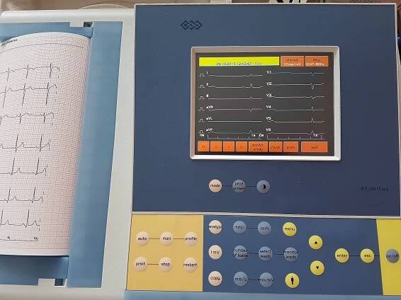 Elektrokardiograf snímá srdeční činnost a tiskne záznam (elektrokardiogram)