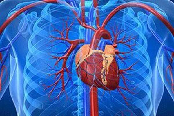 Aneurysma aorty / Aneuryzma | Užitečné informace a tipy na péči o sebe. Zdraví, výživa a další.