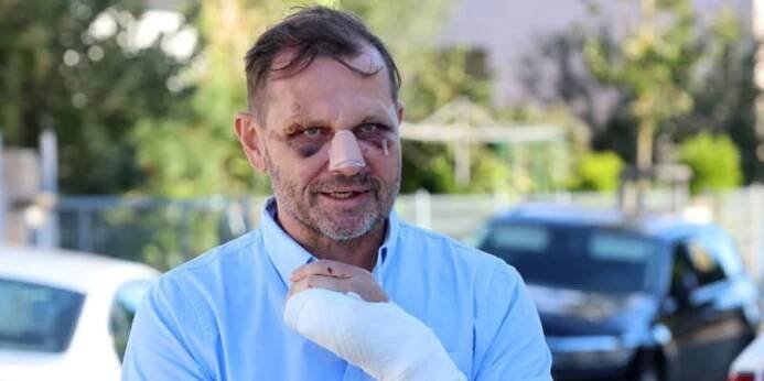 Jaromír Soukup po potyčce s Mirkem Dopitou