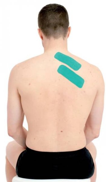 Tejpování rombických svalů 1