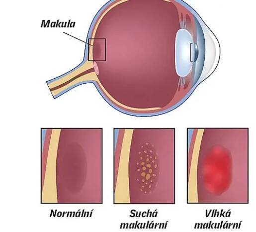 makula