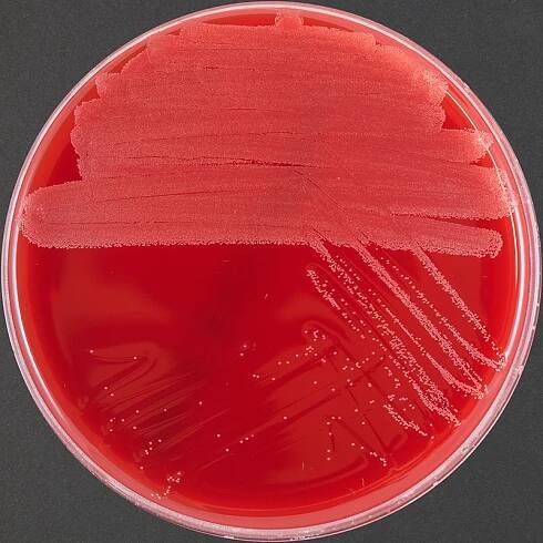Methylene Blue stain