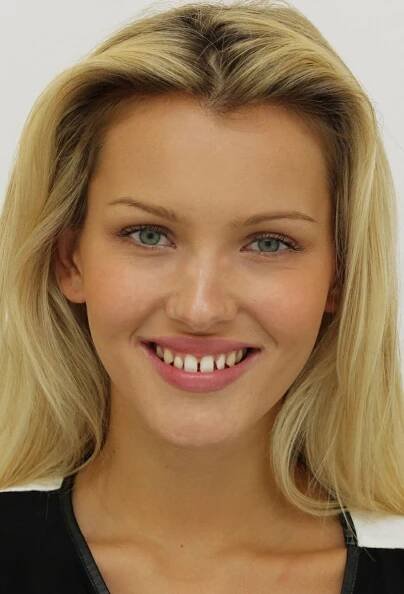 To je změna: Česká Miss World si nechala opravit příšerně křivé zuby: Stálo ji to balík