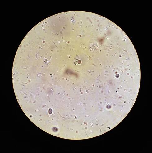 Zobrazit v mikroskopu na Trichomonas Std — Stock obrázek