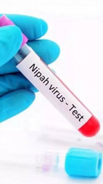 Kerala reports two Nipah virus deaths; Expert team dispatched by Centre