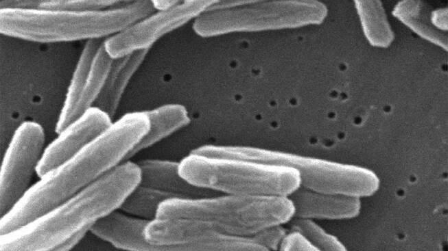 An electron microscope image of Mycobacterium tuberculosis bacteria, which causes the disease tuberculosis.