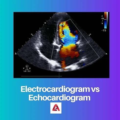 Elektrokardiogram vs Echokardiogram: Rozdíl a srovnání