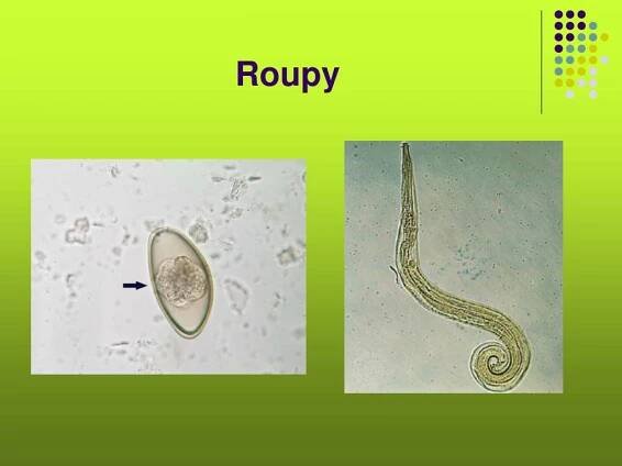 PPT - Poruchy a nemoci trávicí soustavy PowerPoint Presentation, free download - ID:3852536