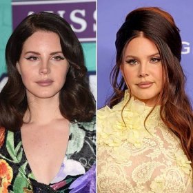 Forever ~Young and Beautiful~? See Lana Del Rey’s Then and Now Photos Amid Plastic Surgery Rumors