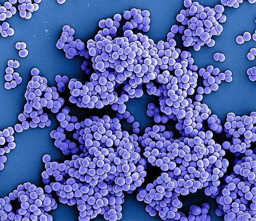 Koloriertes Bild von Methicillin-resistenten Staphylococcus aureus-Bakterien (MRSA); rasterelektronenmikroskopische Aufnahme, die in der NIAID Integrated Research Facility (IRF) in Fort Detrick, Maryland, aufgenommen wurde