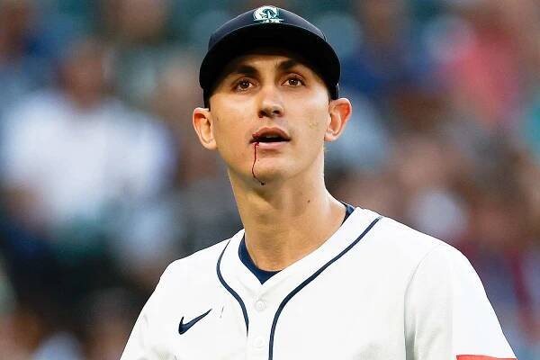 Seattle Mariners Pitcher George Kirby Casually Walks Away After 103 MPH Line Drive to the Face: 'It Didn't Even Hurt'