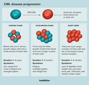 Disease progression in chronic myeloid leukemia (CML)