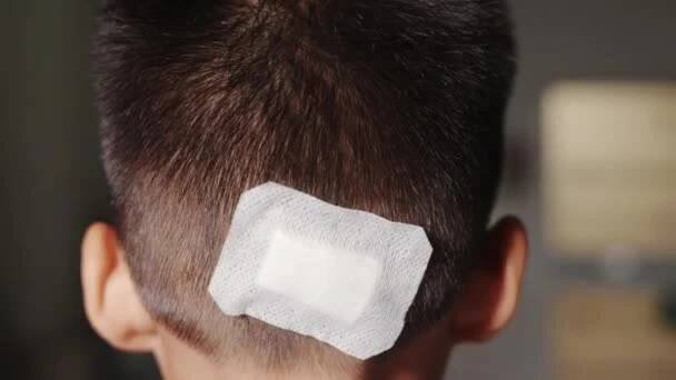 Zraněná šicí rána na dětské zadní části hlavy, která šije s traumatem hlavy zdravotnickým obvazem, Lékařská péče o chirurgické léze na hlavě, Děti úrazu — Stock záběr