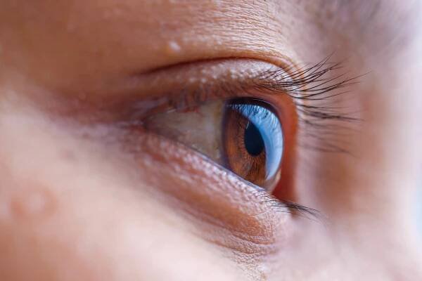 Dry Eyes That Water: Causes, When to See a Doctor, and Treatment – 