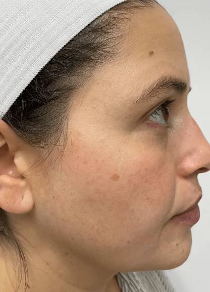 Top-Rated Cosmetic Dermatology Experts - Mandel Dermatology 