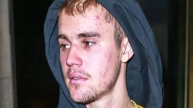GALERIE: Justin Bieber končí s hudbou?! Slavný zpěvák se potýká s psychickými problémy. Fanouškům poslal dojemný vzkaz