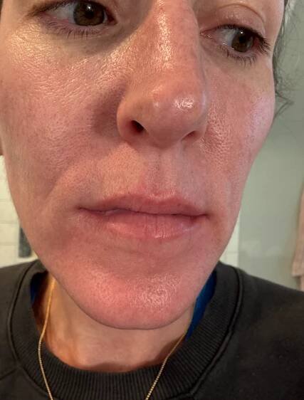 Ourself Lip Filler 