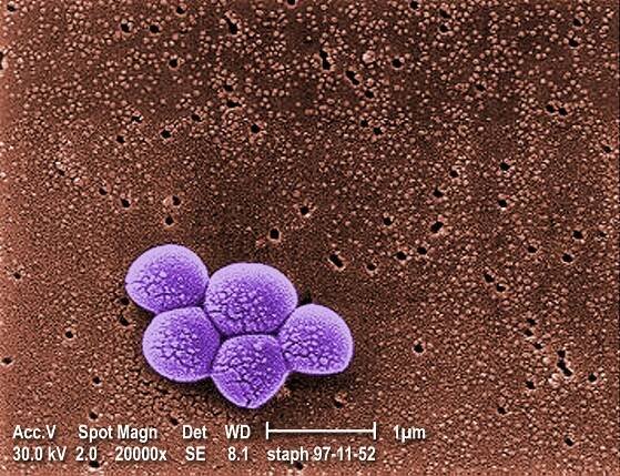 Methicillin-resistant Staphylococcus aureus - Wikipedia