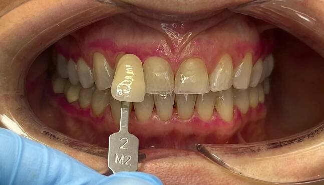 DENTÁLNÍ HYGIENA | Ortodoncie MUDr. Hana Benešová 